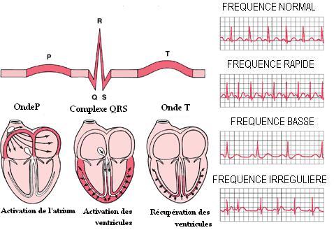 Les troubles du rythme cardiaque